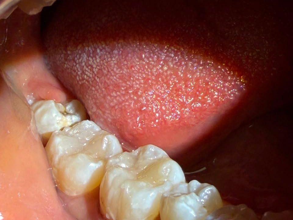 Soins des caries à Tétouan, Centre Dentaire El Attabi