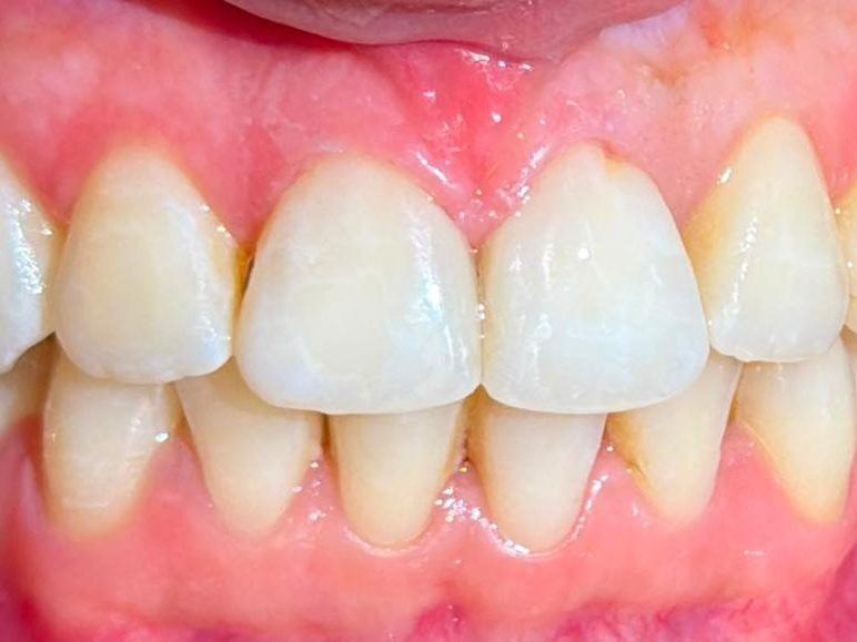 Dentisterie esthétique à Tétouan, Centre Dentaire El Attabi